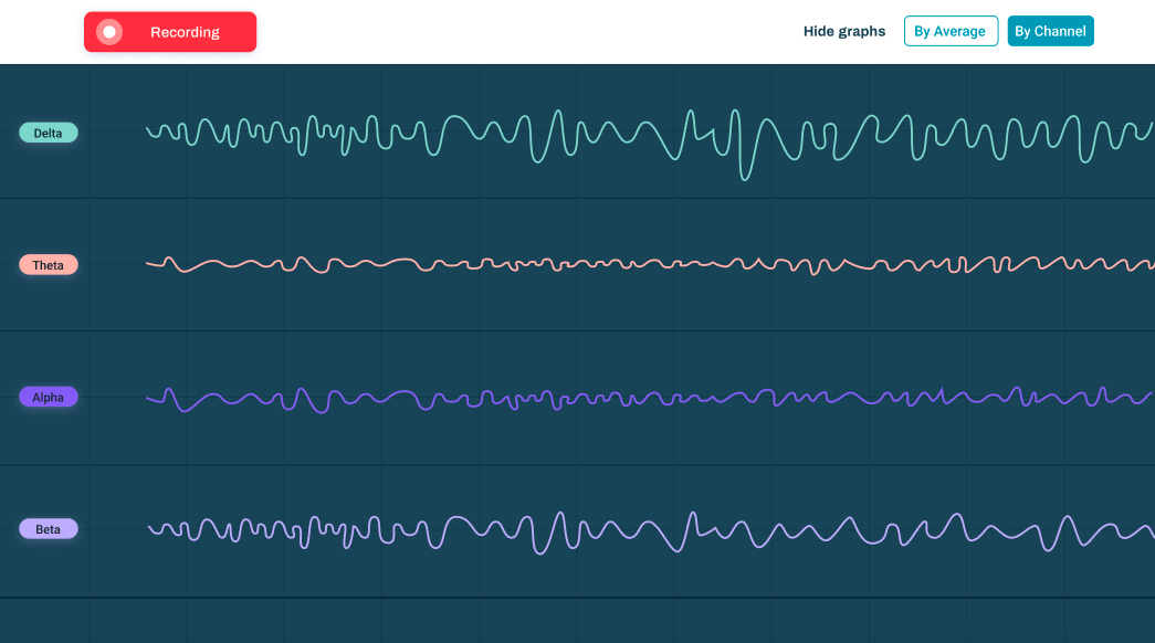 Brain Data